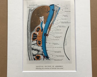 1942 Sagittal Section of Abdomen Original Vintage Anatomical Print - Organs- Anatomy - Medical Decor - Biology - Available Framed