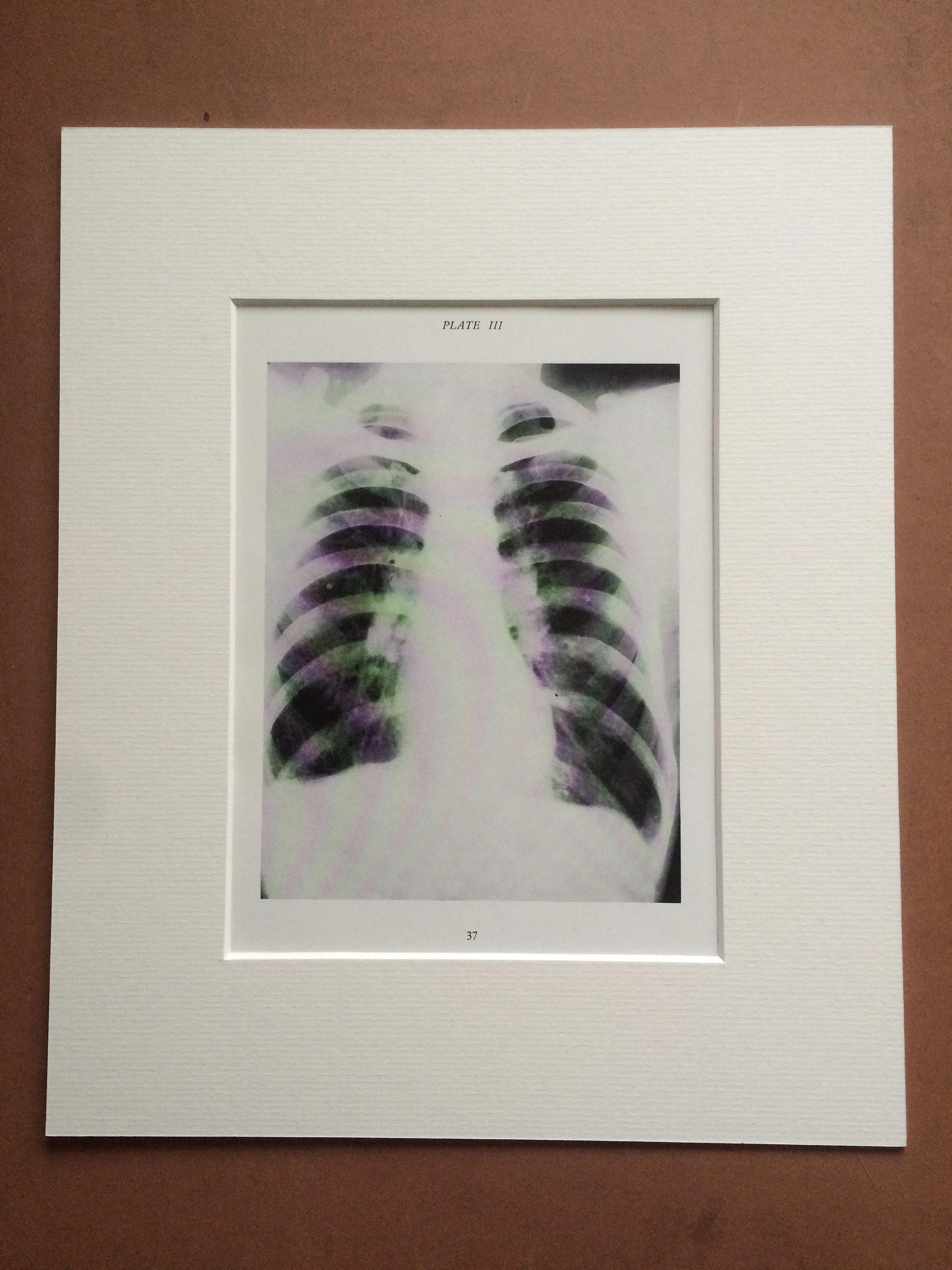 1941 chest lung x ray original vintage print mounted and matted