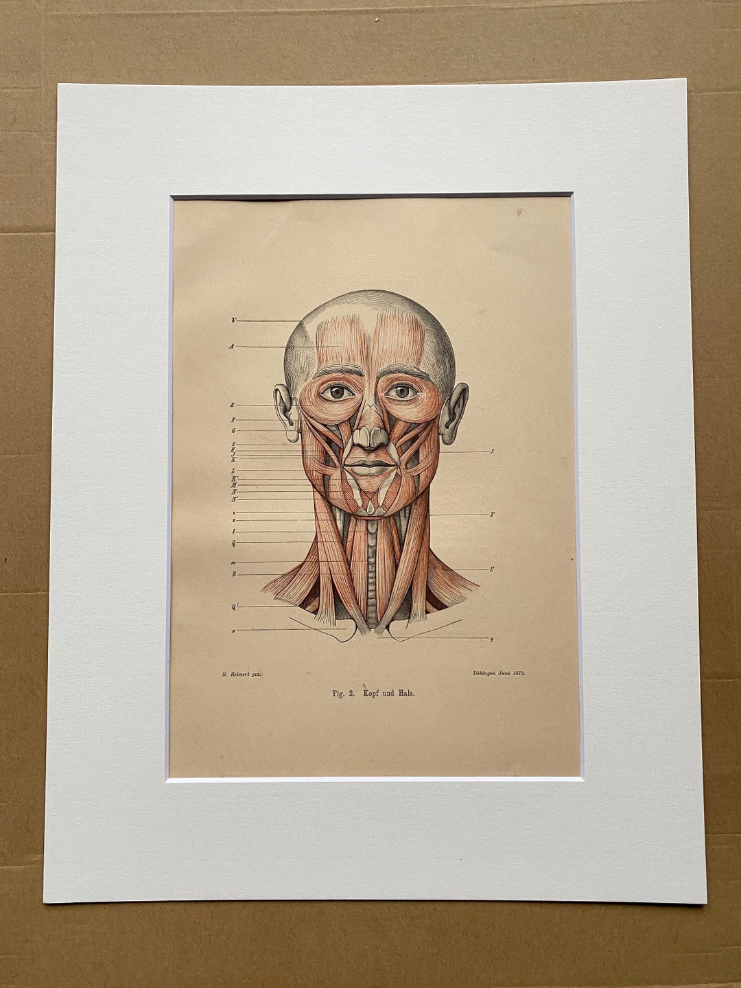 1890 Original Antique Anatomical Print - Head and Neck Muscles ...