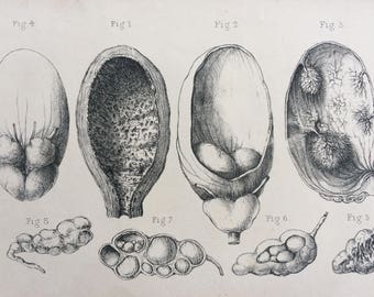 1831 Original Antique Anatomical Print by W. Money - Morbid Anatomy  - Pathology - Gift for Doctor or Medical Student - Oddity - Curiosity