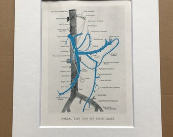1942 Portal Vein and its Tributaries Original Vintage Anatomical Print - Organ- Anatomy - Medical Decor - Biology - Available Framed