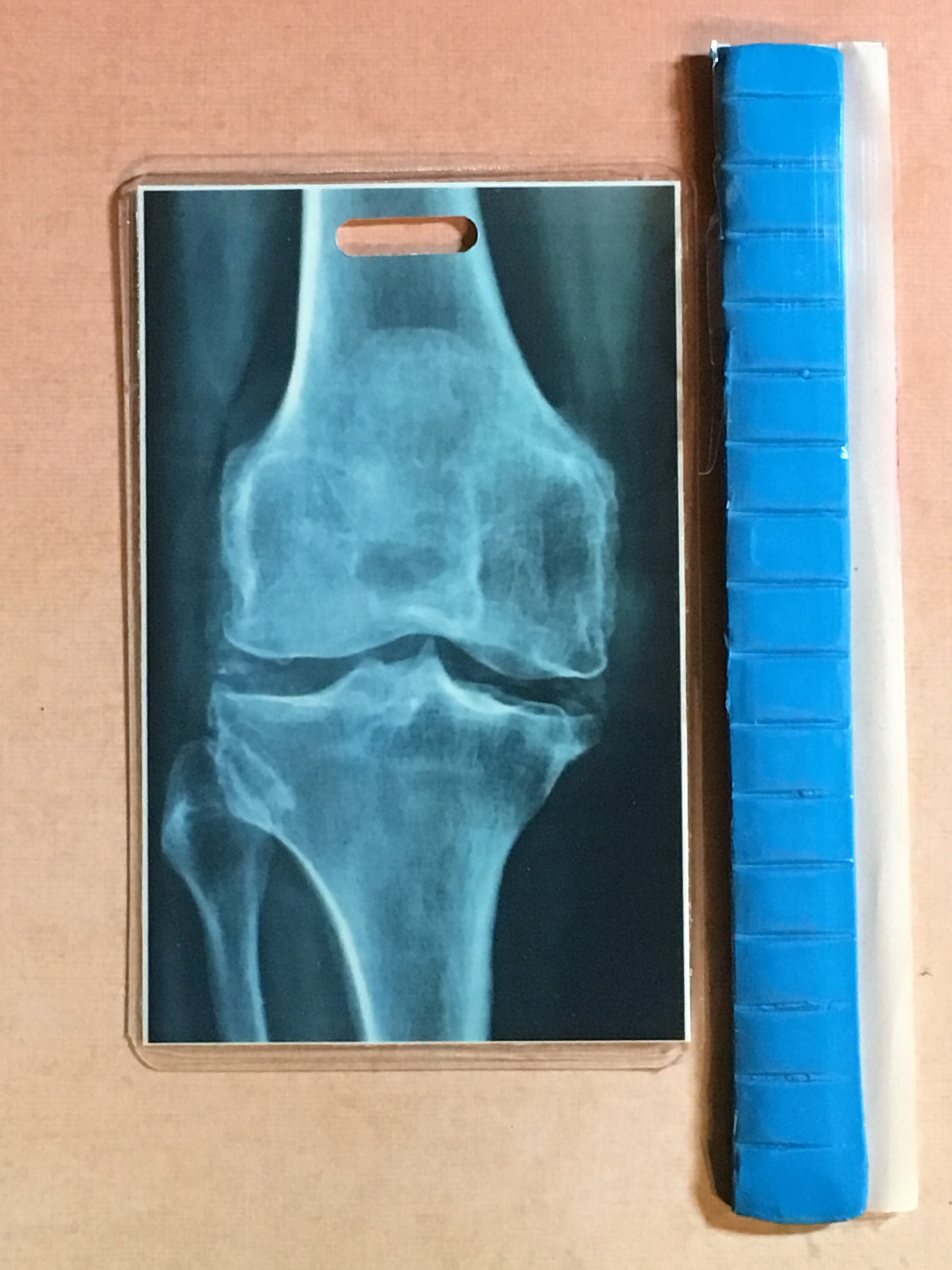 Knee Bone Vertical Xray Marker Holder Card And Putty Set