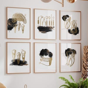 Dental teeth pictures dentist office wall art, odontologia orthodontic medical clinic anatomy tooth artwork, modern black gold print set