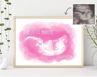 Watercolour Baby Scan Ultrasound Print Shower Gift For Mum To Be Pregnancy Gifts Keepsake Bump Custom 2D 3D 4D My First Scan Boy or Girl