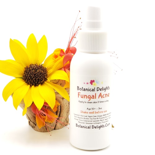 Tinea Versicolor treatment for pregnant and nursing mothers, Haole Rot