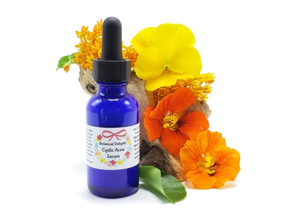 cystic acne serum
