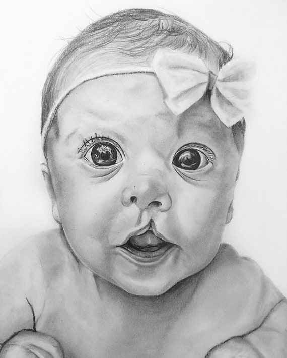 Pencil Sketch Drawing Of Child Cleft Lip Pallete First Smile Etsy
