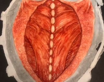 Exposed Spine Prosthetic