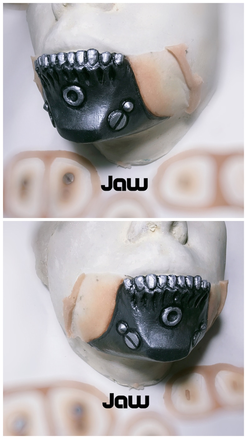 May include: Close-up of a black and silver prosthetic jaw with the word "Jaw" printed below it.