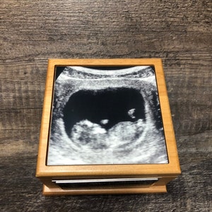Miscarriage Urn Cremation Urn Baby Loss Memorial Keepsake Urn For Ashes Infant Urn Ultrasound Photo & Personalized Engraved Memorial Gift image 2