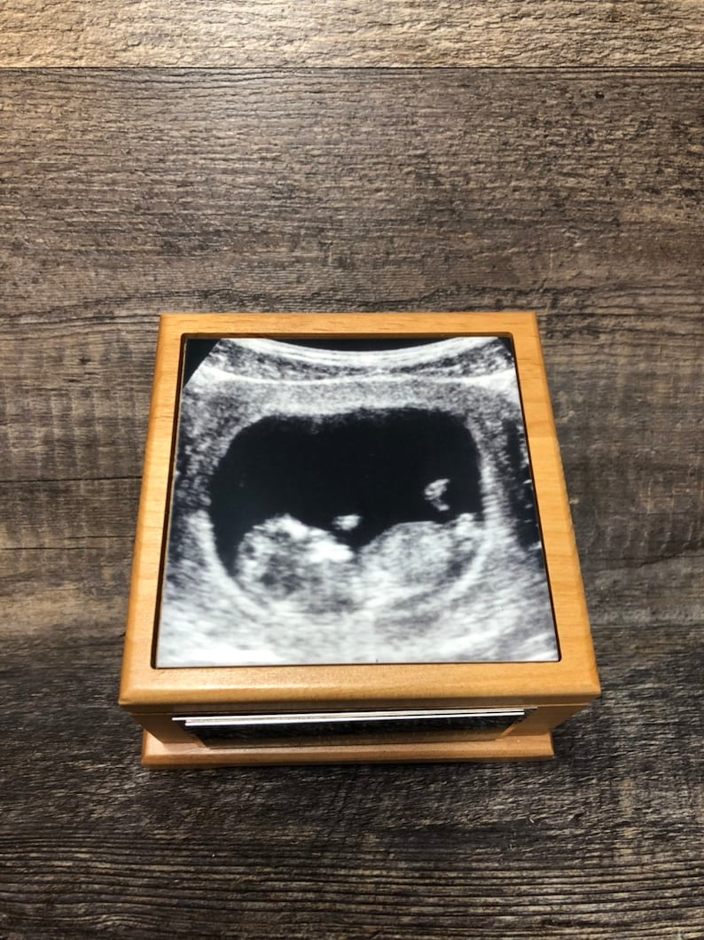 Miscarriage Urn Cremation Urn Baby Loss Memorial Keepsake Urn For Ashes Infant Urn Ultrasound Photo & Personalized Engraved Memorial Gift image 2