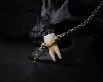 A Tooth - Two Roots - Charm Bracelet - Painting Version by Defy