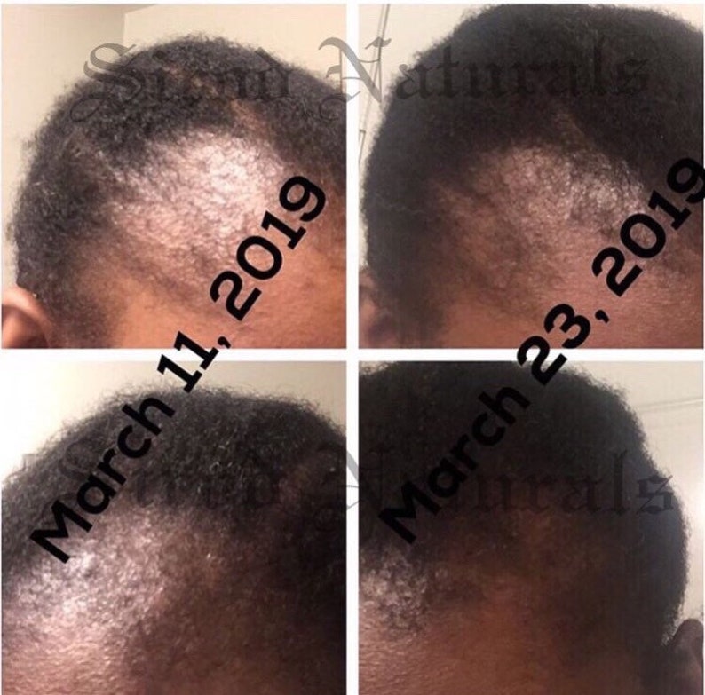 Fermented Rice Milk Leavein Conditioner With Ayurvedic Herbs Etsy