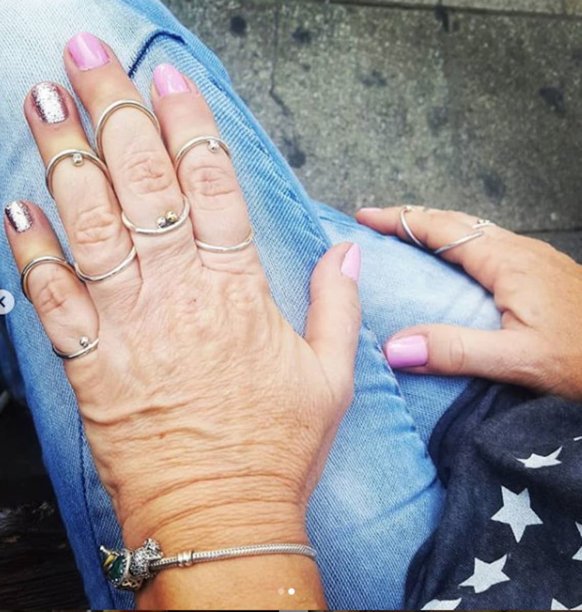 EDS Hypermobylity / Arthritis / Swan Neck ring splints set of Etsy