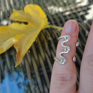 Arthritis silver ring splint