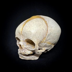 Fetal skull replica