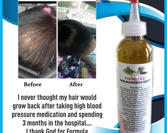 Hair Oil Formula D Hair Regrowth Serum For Fast Hair Growth Etsy