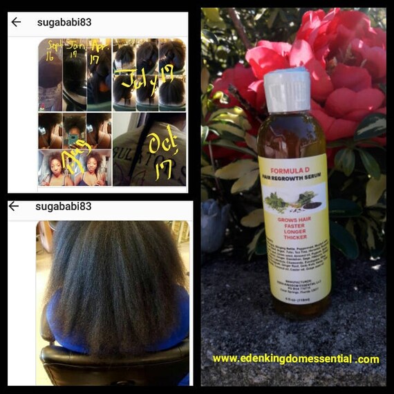 Formula D Hair ReGrowth Serum Good For CCCA- Baldspots-BigChop- Hair Growth Oil For All Hair Types Teens, Kids, Breakage Fast Acting