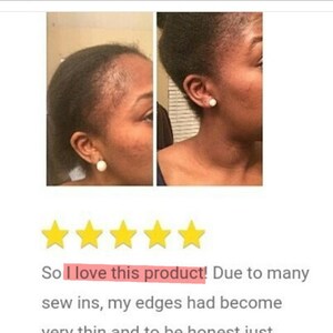May include: Before and after photos of a person's hair. The before photo shows thinning hair around the edges. The after photo shows fuller hair. The text reads "So I love this product! Due to many sew ins, my edges had become very thin and to be honest just weren't there. With just two weeks"