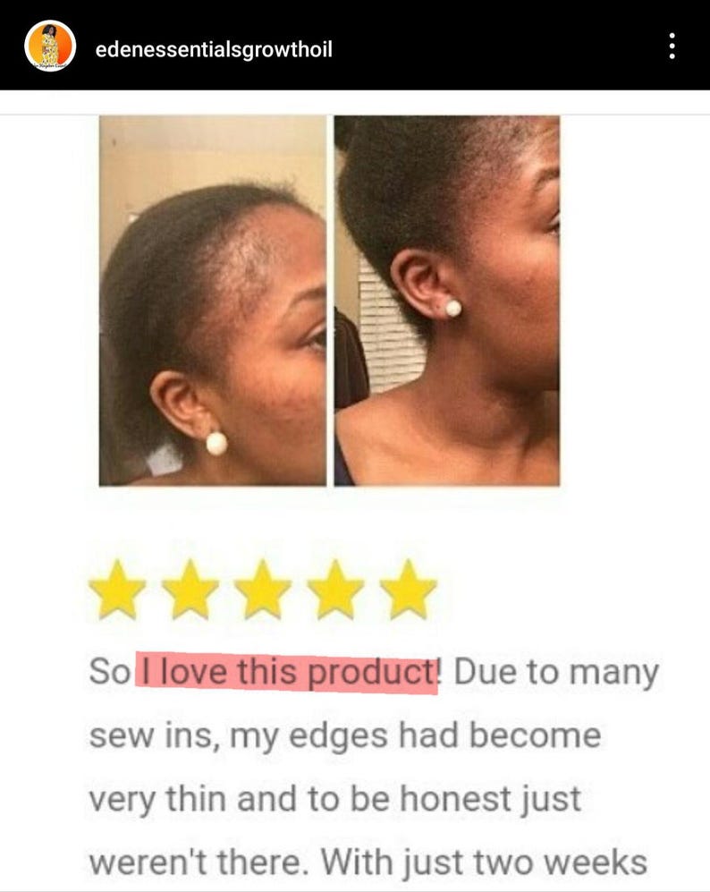 May include: Before and after photos of a person's hair. The before photo shows thinning hair around the edges. The after photo shows fuller hair. The text reads "So I love this product! Due to many sew ins, my edges had become very thin and to be honest just weren't there. With just two weeks"