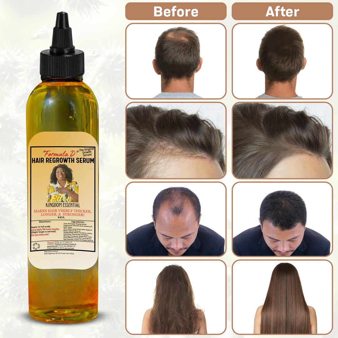 Extra Strength Hair Growth Oil DHT Blocker for Receding Hairline Amla