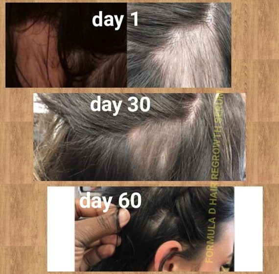 YouTube Viral Clove Water Rinse For Fast Hair Growth Gallon Size Resale Wholesale Private Label We Supply Most Companies In This Industry