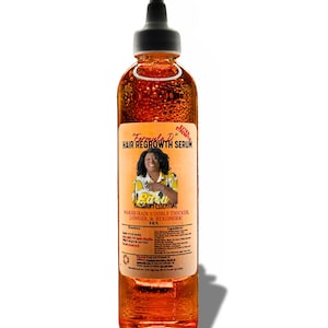 Extra Strength Hair Growth Oil |Receding Hairline| Thinning Edges | JBCO & Amla Blend| EARTH MADE &quot;Rogaine&quot; for Men and Women!