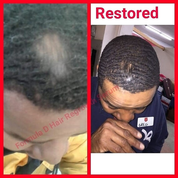 Cooper S Beard Oil And Receding Hairline Oil For Men Etsy