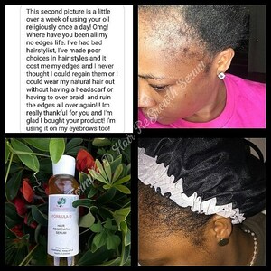 May include: A close-up of a brown glass bottle with a label that reads "Formula D Hair Regrowth Serum". The bottle is sitting on a green leafy background. The text "This second picture is a little over a week of using your oil religiously once a day! Omg! Where have you been all my no edges life. I've had bad hairstylist, I've made poor choices in hair styles and it cost me my edges and I never thought I could regain them or I could wear my natural hair out without having a headscarf or having to over braid and ruin the edges all over again!!! Im really thankful for you and I'm glad I bought your product! I'm using it on my eyebrows too!" is visible in the image.