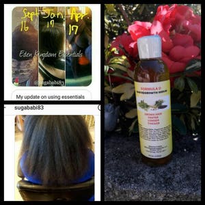 May include: A before and after photo showing hair growth using a hair growth serum. The serum bottle is labeled "Formula D Hair Regrowth Serum" and claims to grow hair faster, longer, and thicker. The photo shows a woman's hair at three different stages of growth.