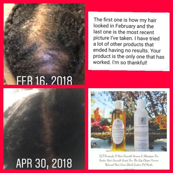 Black 2024 hair wholesalers