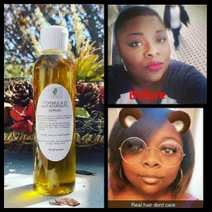 May include: A clear glass bottle with a brown label that reads "Formula D Hair Regrowth Serum". The bottle is filled with a golden liquid and is sitting on a table with a brown surface. The bottle is 4 fluid ounces.