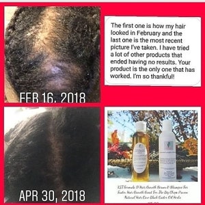 Pu&ograve; includere: Foto prima e dopo che mostrano la crescita dei capelli. La prima foto &egrave; datata 16 febbraio 2018 e mostra una persona con i capelli radi. La seconda foto &egrave; datata 30 aprile 2018 e mostra la stessa persona con i capelli pi&ugrave; folti. Il testo nell'immagine recita: "La prima foto mostra come erano i miei capelli a febbraio e l'ultima foto &egrave; la pi&ugrave; recente che ho scattato. Ho provato molti altri prodotti che non hanno dato alcun risultato. Il tuo prodotto &egrave; l'unico che ha funzionato. Sono cos&igrave; grata!" Nell'immagine sono mostrate due bottiglie di siero e shampoo per la crescita dei capelli.