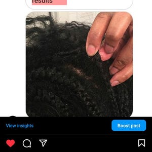 Pu&ograve; includere: Primo piano dei capelli di una persona che mostra una nuova crescita dopo aver usato un olio per la crescita dei capelli. La didascalia recita: "Non sono sicura se puoi usare questa foto perch&eacute; i miei capelli sono cos&igrave; sporchi, ma dopo solo 4 settimane con le mie trecce, ho avuto risultati incredibili."