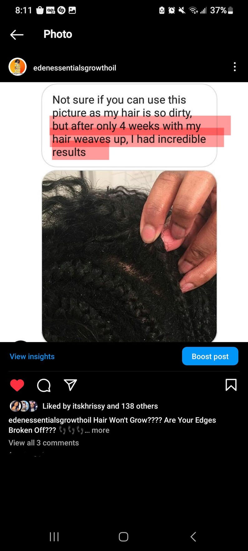 Pu&ograve; includere: Primo piano dei capelli di una persona che mostra una nuova crescita dopo aver usato un olio per la crescita dei capelli. La didascalia recita: "Non sono sicura se puoi usare questa foto perch&eacute; i miei capelli sono cos&igrave; sporchi, ma dopo solo 4 settimane con le mie trecce, ho avuto risultati incredibili."