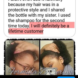 Pu&ograve; includere: Una foto prima e dopo che mostra i risultati dell'utilizzo di un siero per la crescita dei capelli. Il testo nell'immagine recita: "Non l'ho nemmeno usato fedelmente perch&eacute; i miei capelli erano in uno stile protettivo e ho condiviso la bottiglia con mia sorella. Ho usato lo shampoo per la seconda volta oggi. Sar&ograve; sicuramente una cliente fedele."