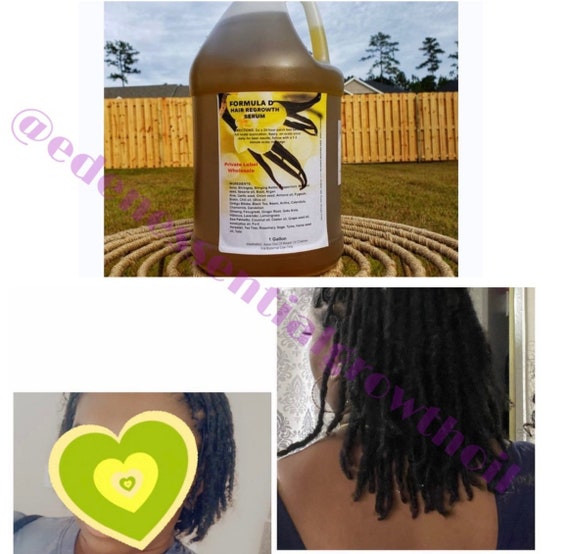 Private Label Hair Care Products-5 Gallons Potent Hair Growth - Etsy Private Label Hair Care Products-5 Gallons Potent Hair Growth - Etsy