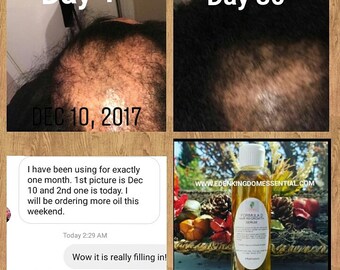 Private Label Hair Care Products-natural Hair - Etsy