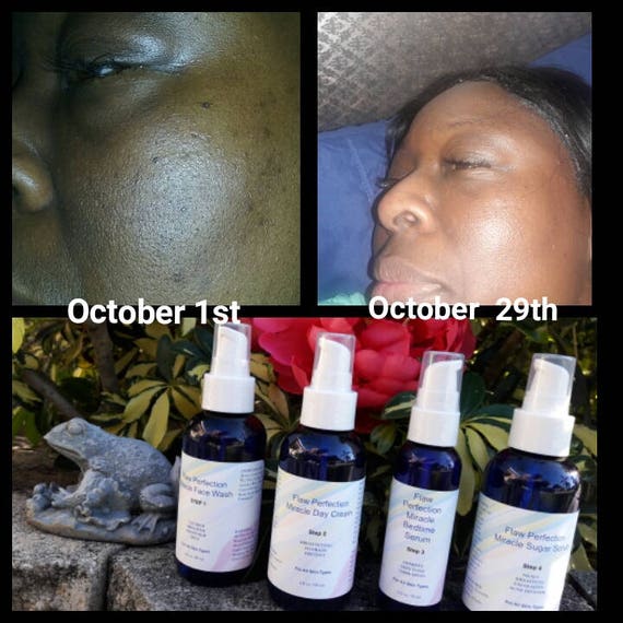 Flaw Perfection Miracle Skin Care System For Dark Spots -Pimples-Blemishes -Uneven Skin Tone-Imperfections