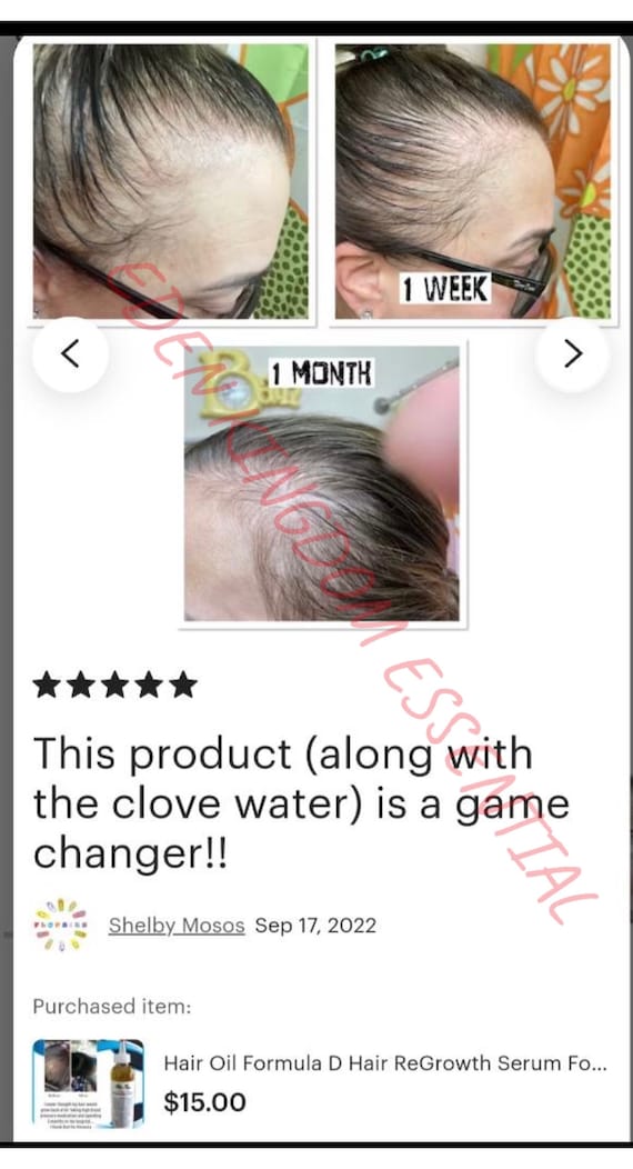 KIT:Formula D Hair Re-Growth Oil Serum & Shampoo DHT Blocker - Hair Loss Treatment for Men or Women, Alopecia Natural Hair Black Castor Oil