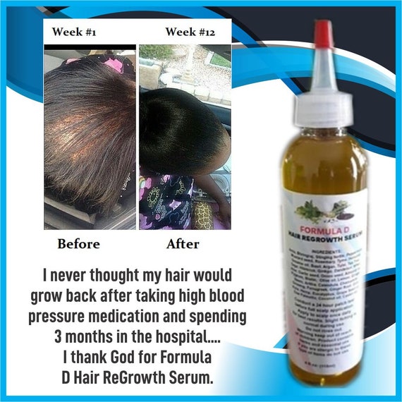 Hair Oil Formula D Hair Regrowth Serum For Fast Hair Growth Etsy