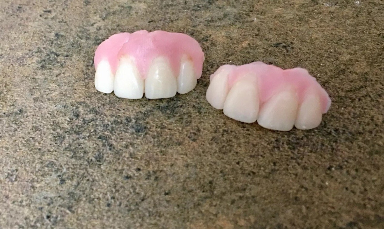 Missing Tooth A1 Veneer Kit Front 6 Teeth Shade A1 white False Etsy