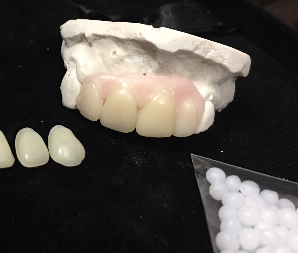 Missing Tooth Kit Front Flipper Denture Resin Denture Teeth Etsy