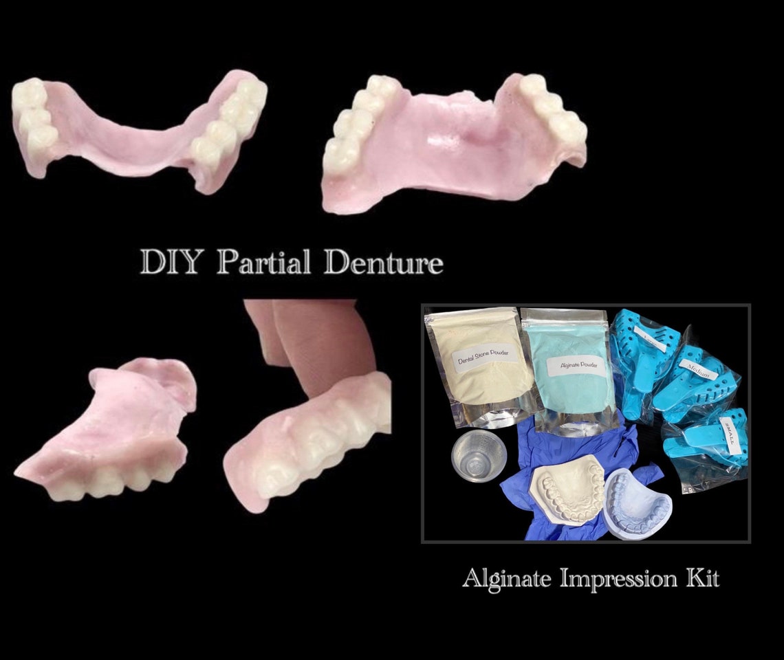 DIY Partial Denture Kit Alginate Impression Mold Affordable Etsy