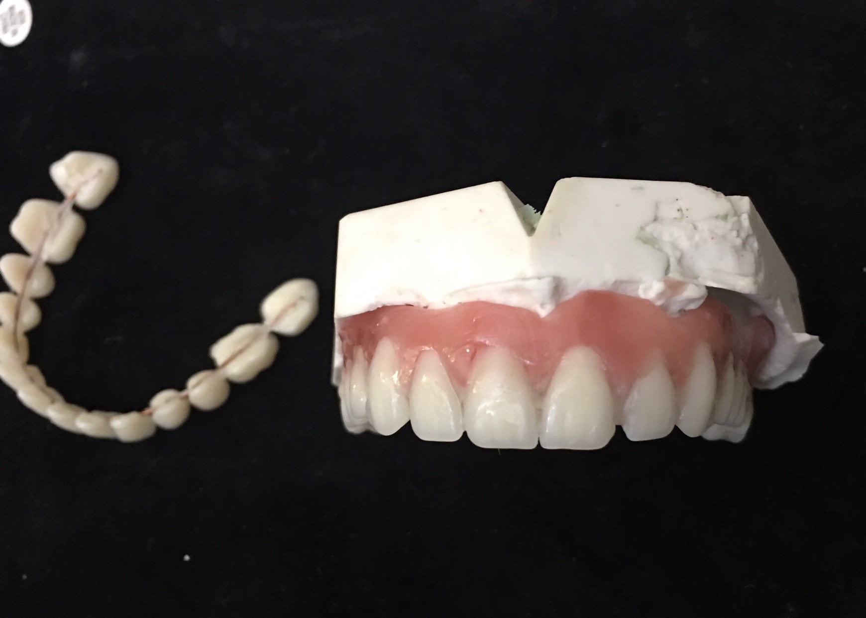 DIY Denture Kit Resin Mold Alginate Dental Impression Cast Etsy