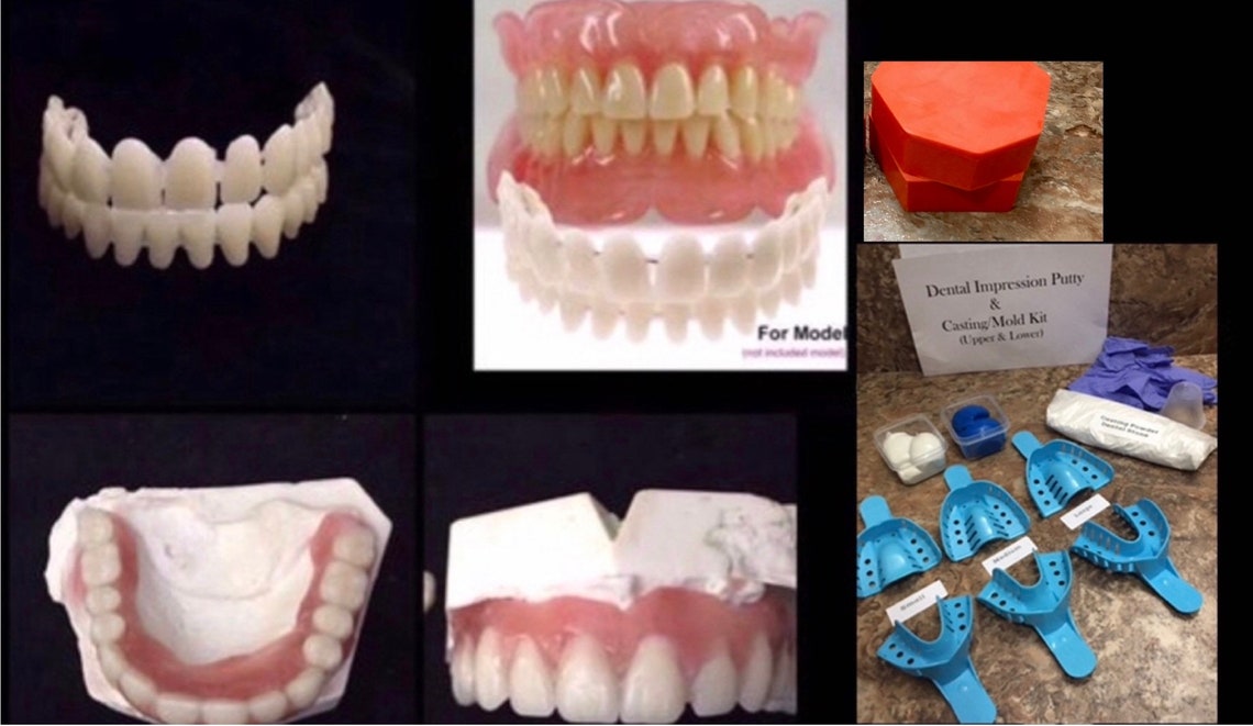 DIY Denture Kit Acrylic Teeth Dental Putty Impression Kit Etsy