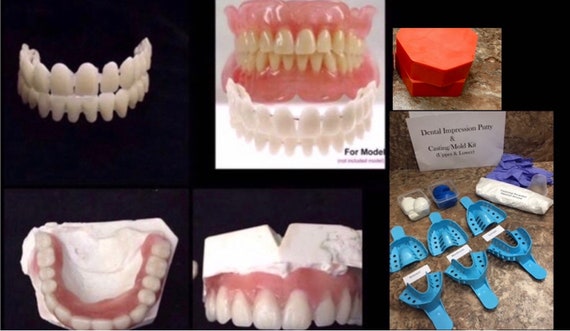 Diy Denture Kit Acrylic Teeth Dental Putty Impression Kit Etsy