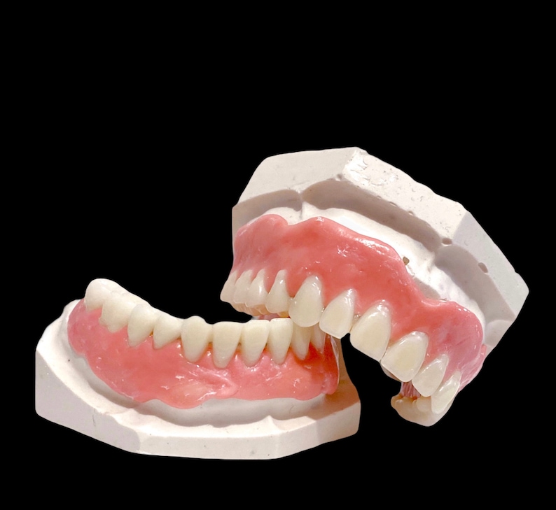 Full Do It Yourself Denture Kit Resin False Teeth Acrylic | Etsy