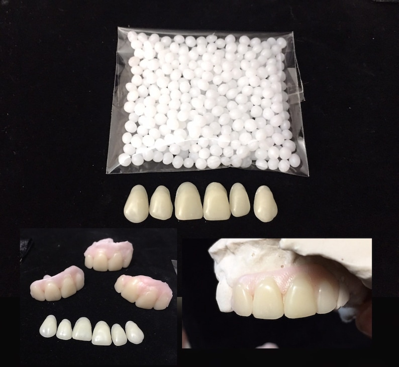 flipper denture teeth partial veneer veneers dentures