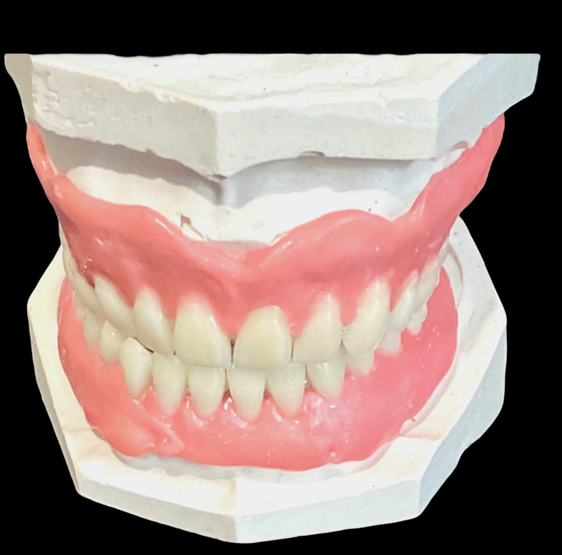 Denture Base Former Dental Impression Dental Stone Powder Etsy